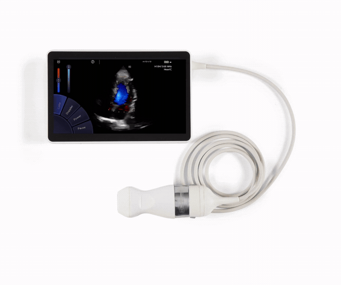 U-Lite Pro — преміальний кишеньковий ультразвуковий апарат Sonoscanner